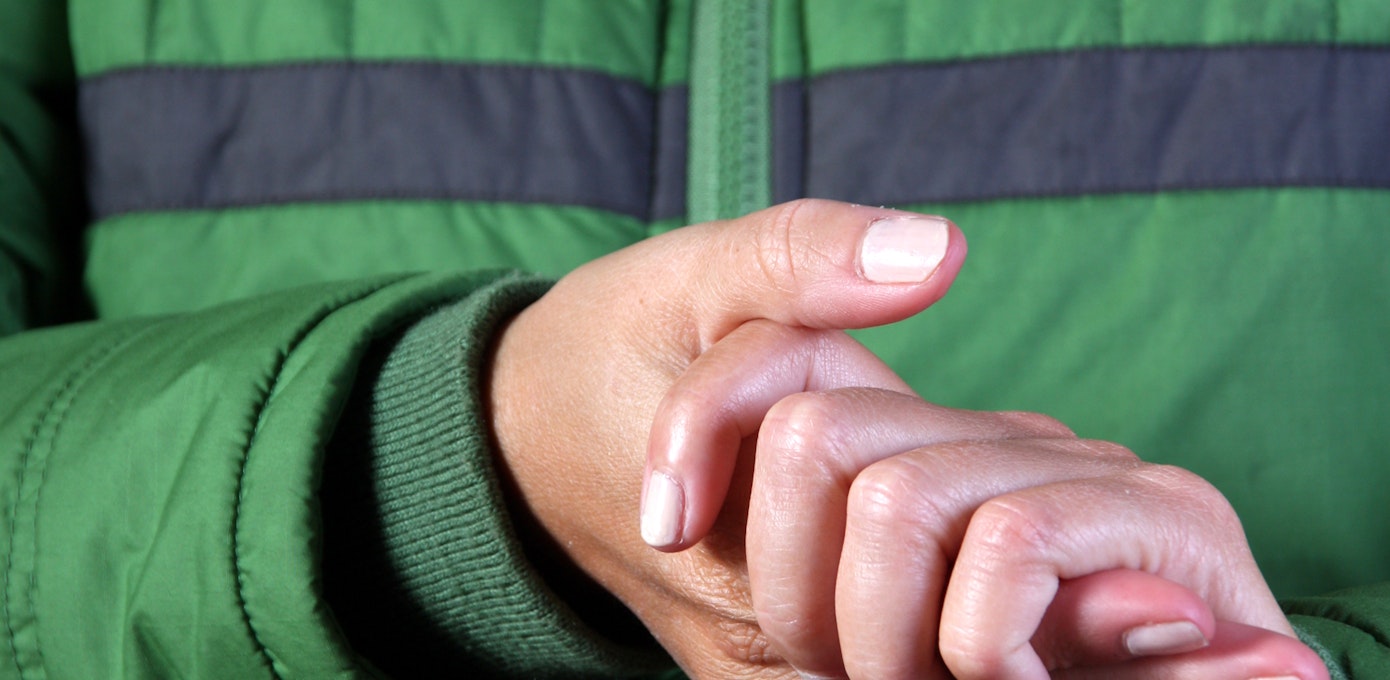 An image depicting a person suffering from cold fingers symptoms