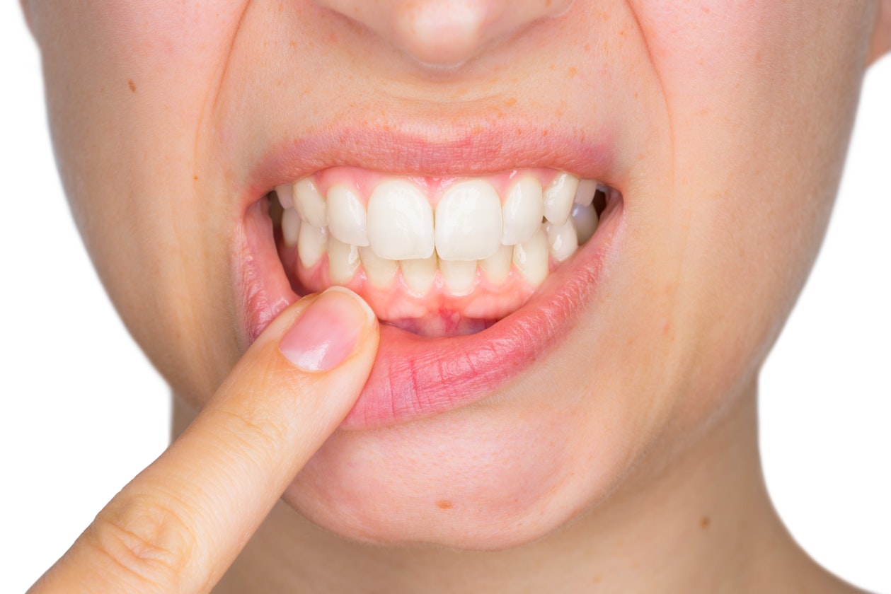 Proper diagnosis of tooth sensitivity is important for proper treatment