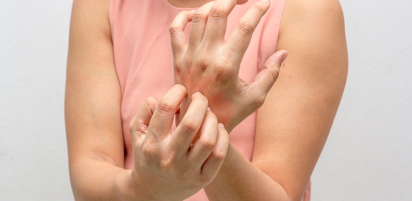 An image depicting a person suffering from hand itch symptoms