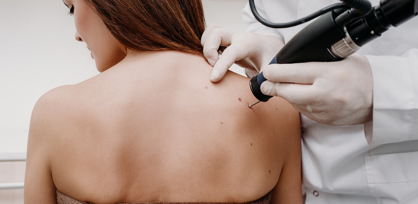 An image depicting a person suffering from hard back mass symptoms