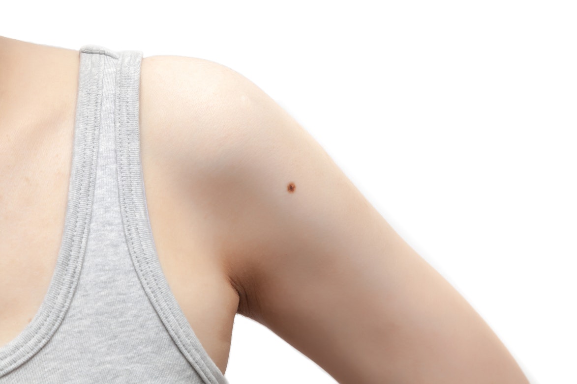Hard Lump In The Armpit Symptoms Causes Common Questions Buoy