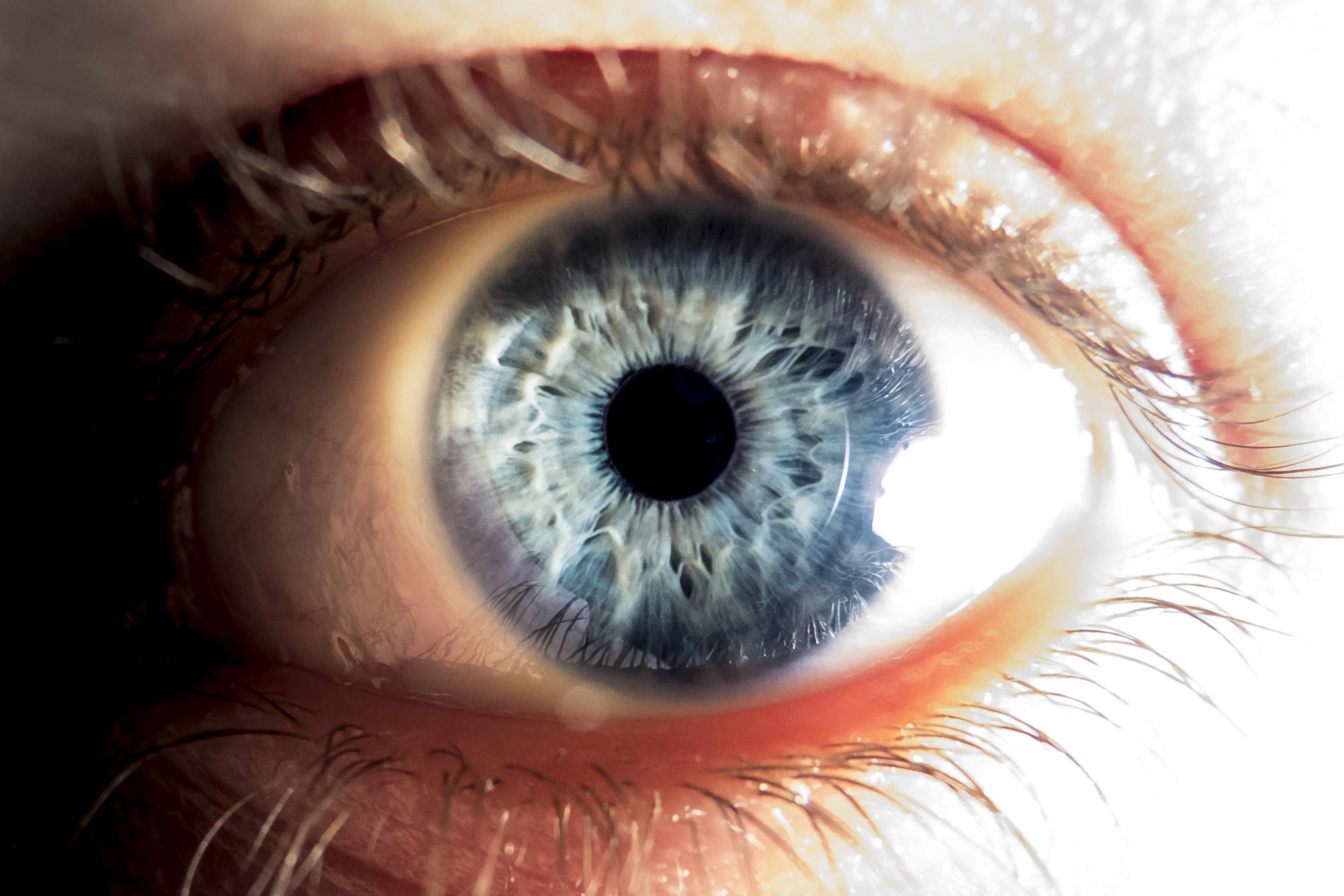 pain behind eyeballs pain behind eyeballs