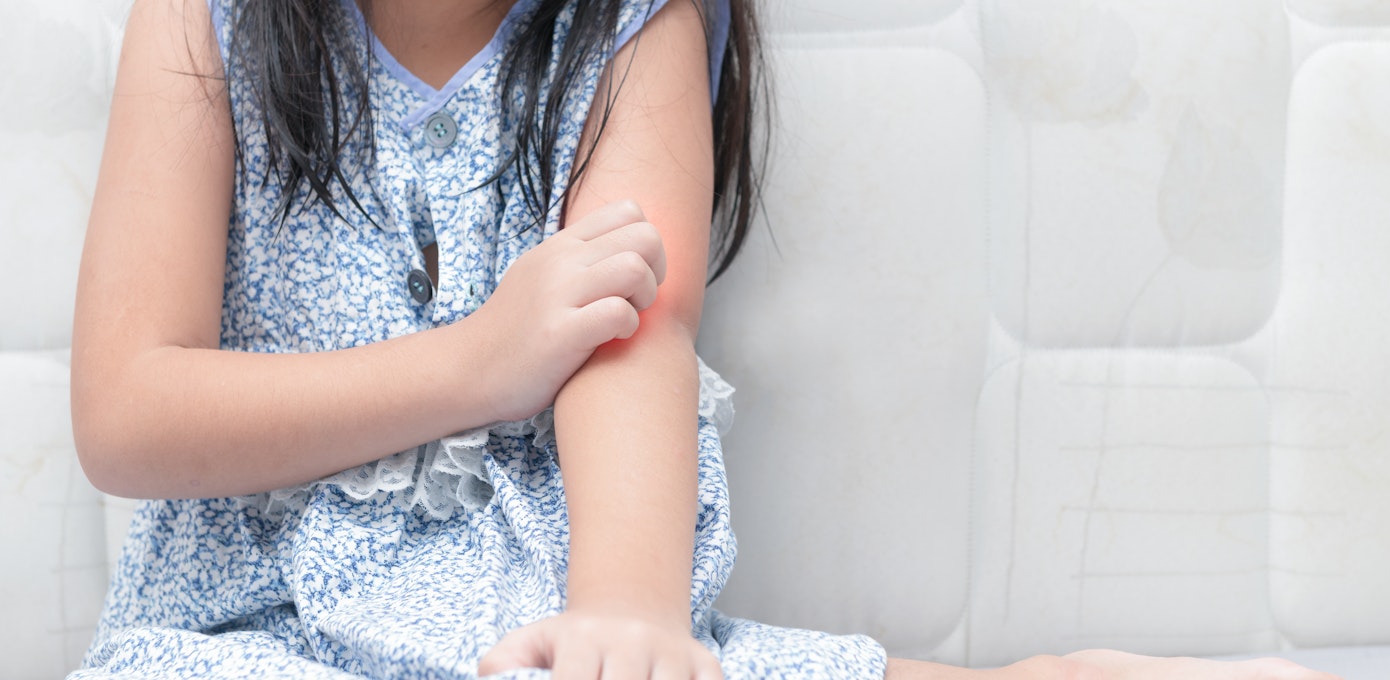 An image depicting a person suffering from painful rash symptoms