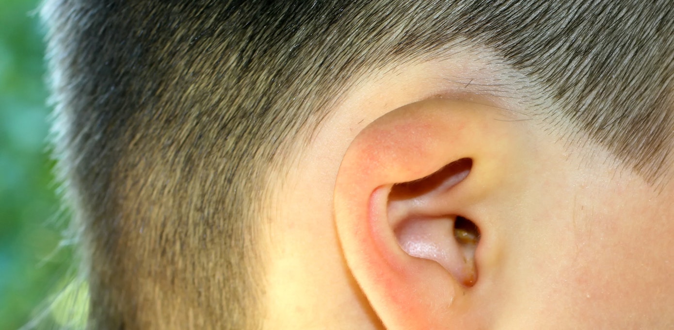 An image depicting a person suffering from swollen ear symptoms