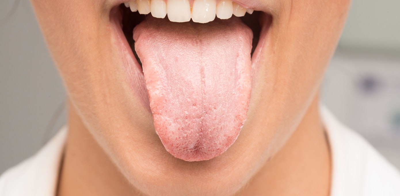 An image depicting a person suffering from tongue pain symptoms